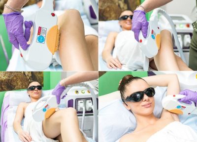 LaserskaepilacijaKaraburma(5)1583321730