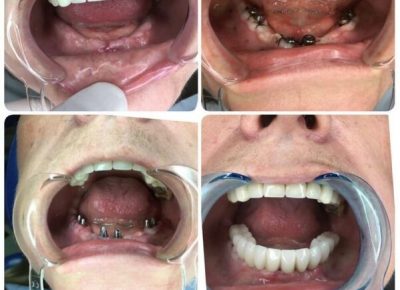 ortodoncijaLoznica61611674783