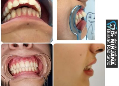 ortodoncijaoznica71611674784