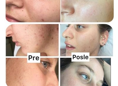 MaderoBezanijskakosa(9)1618835264